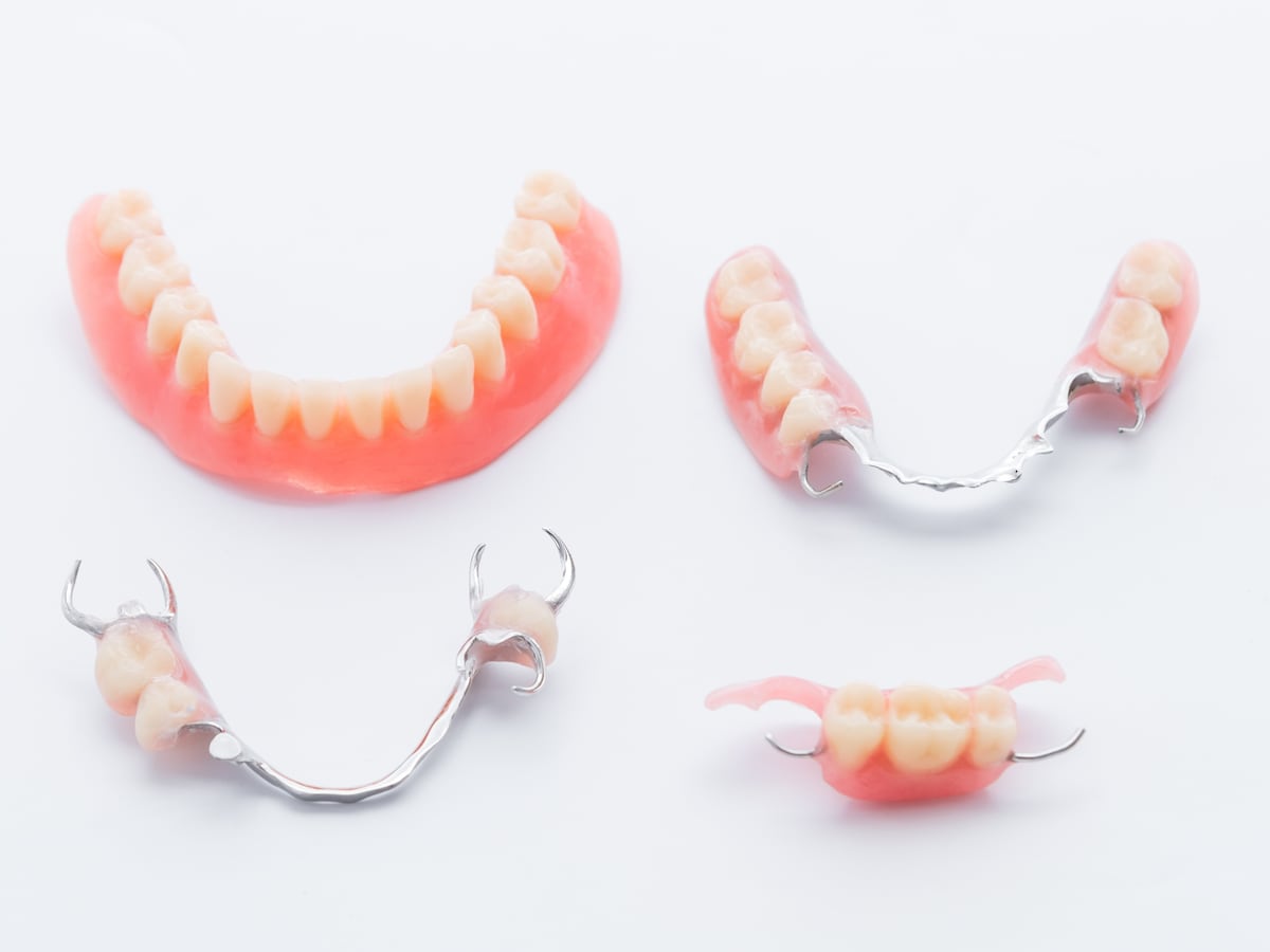 Какие зубные протезы лучше при отсутствии зубов. Съемный протез (3-5 зубов) термо Джет. Съемный протез (6-14 зубов) термо Джет. Полносъемные протезы ортопедическая стоматология. Частичный съемный пластиночный протез на нижнюю челюсть.