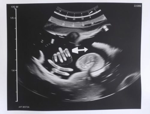 Les Questions à Poser lors de sa Première Échographie: Guía práctica y reconfortante para saber qué preguntar